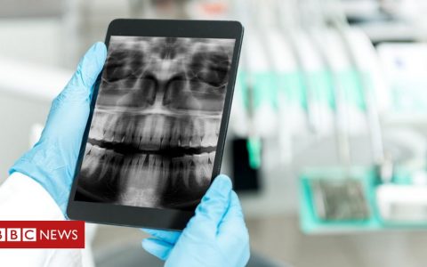 Cardiff dental school accused of racism and bias