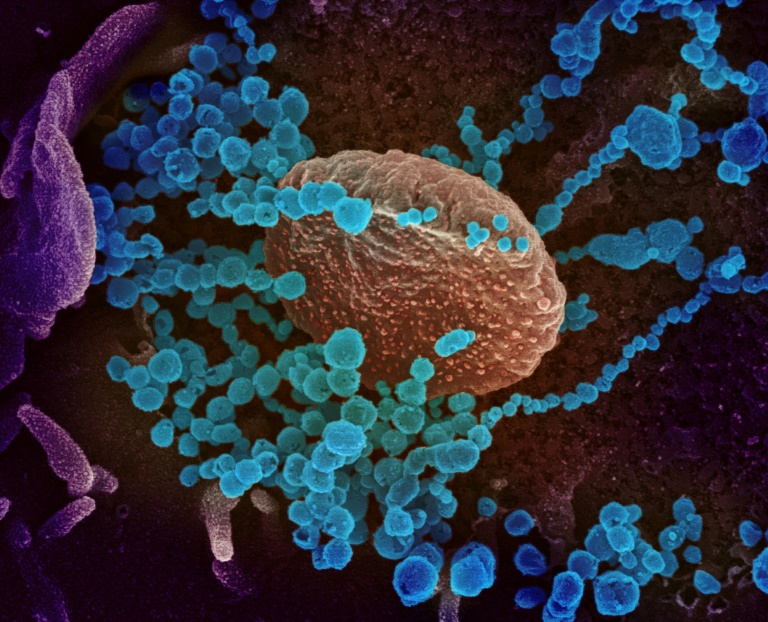 A scanning electron microscope image of SARS-CoV-2 (round blue objects) emerging from the surface of cells cultured in the lab