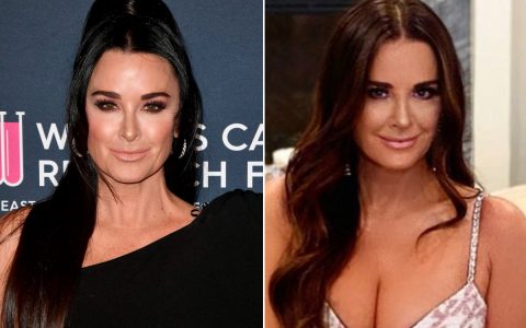 Kyle Richards revealed that he got a nose job after breaking up