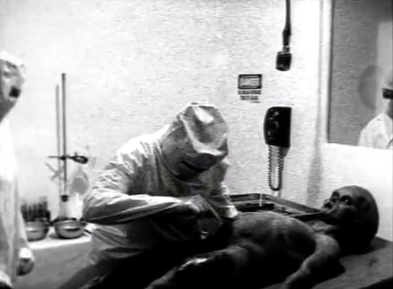 Black and white image showing simulated autopsy on foreign body.