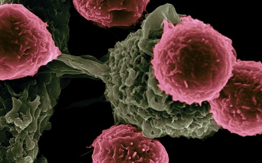 Virus "killing" cancer begins trial in humans - poca Negócios