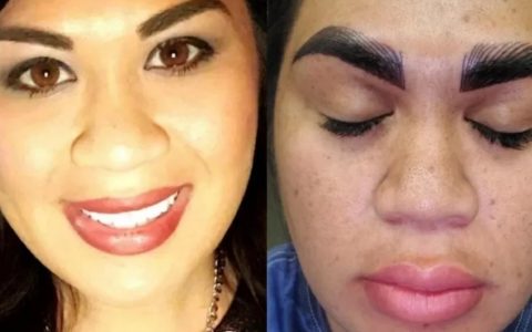 'Terrible', says woman after paying BRL 1,700 for eyebrow procedure