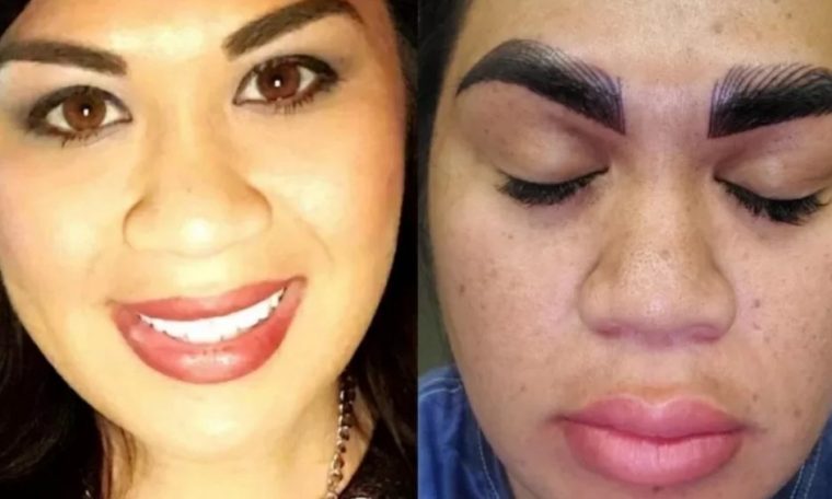 'Terrible', says woman after paying BRL 1,700 for eyebrow procedure