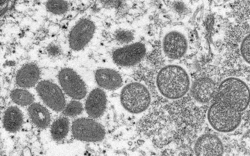 Rio Grande do Sul government confirms second case of monkeypox